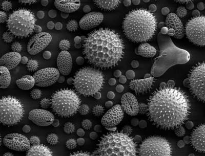 Пчелен прашец наблюдаван с електронен микроскоп. Извънземно красив. Жалко, че не е цветна снимката на прашец.